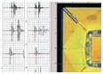 Multipoint waveform display